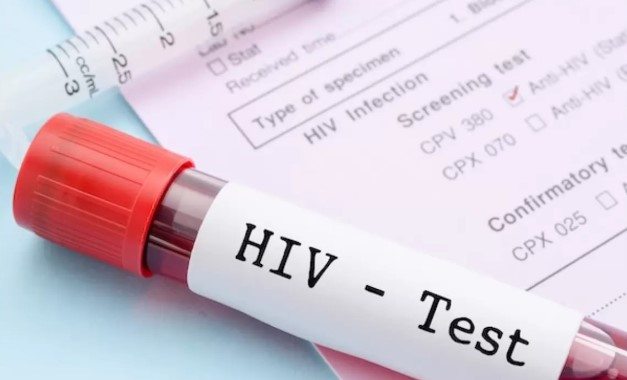 hiv-test